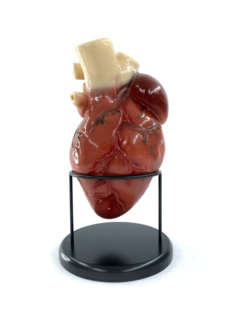 Ref: Corazón Realista Dabiz Muñoz, StreetXo, Londres 0438 - Disponibilidad: Rojo